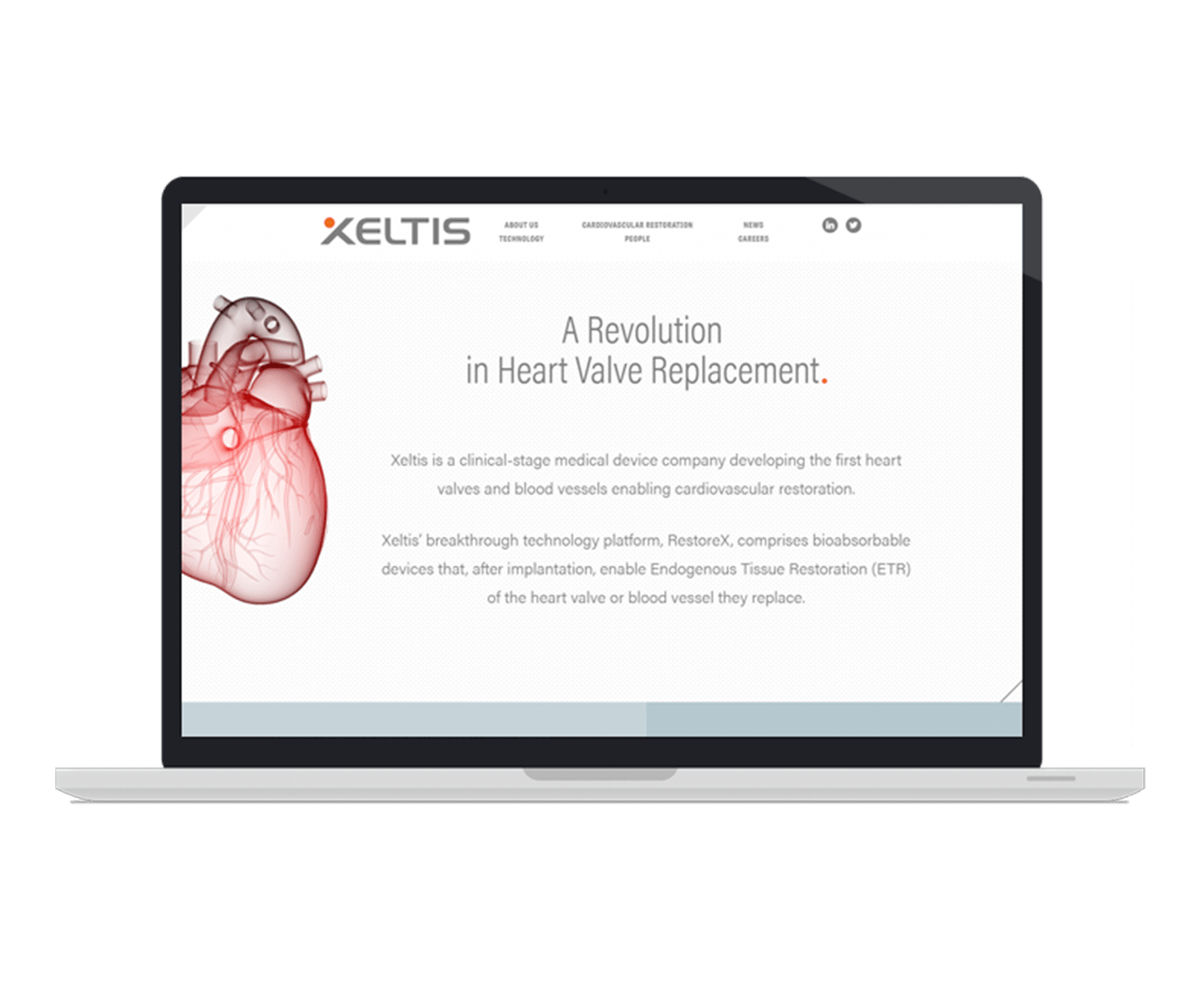 Xeltis Image